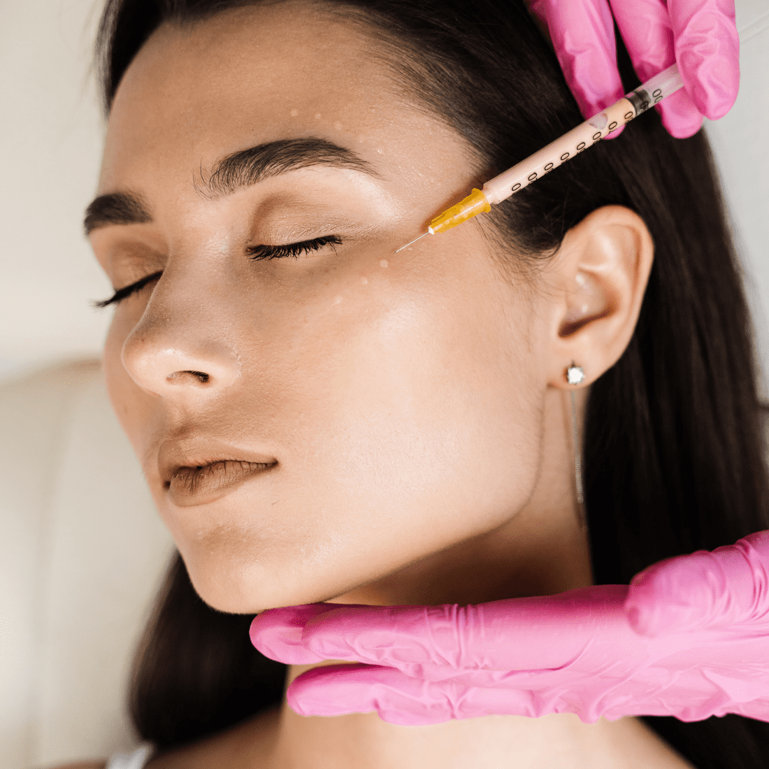 Mezoterapia Igłowa: Naturalna Regeneracja Skóry