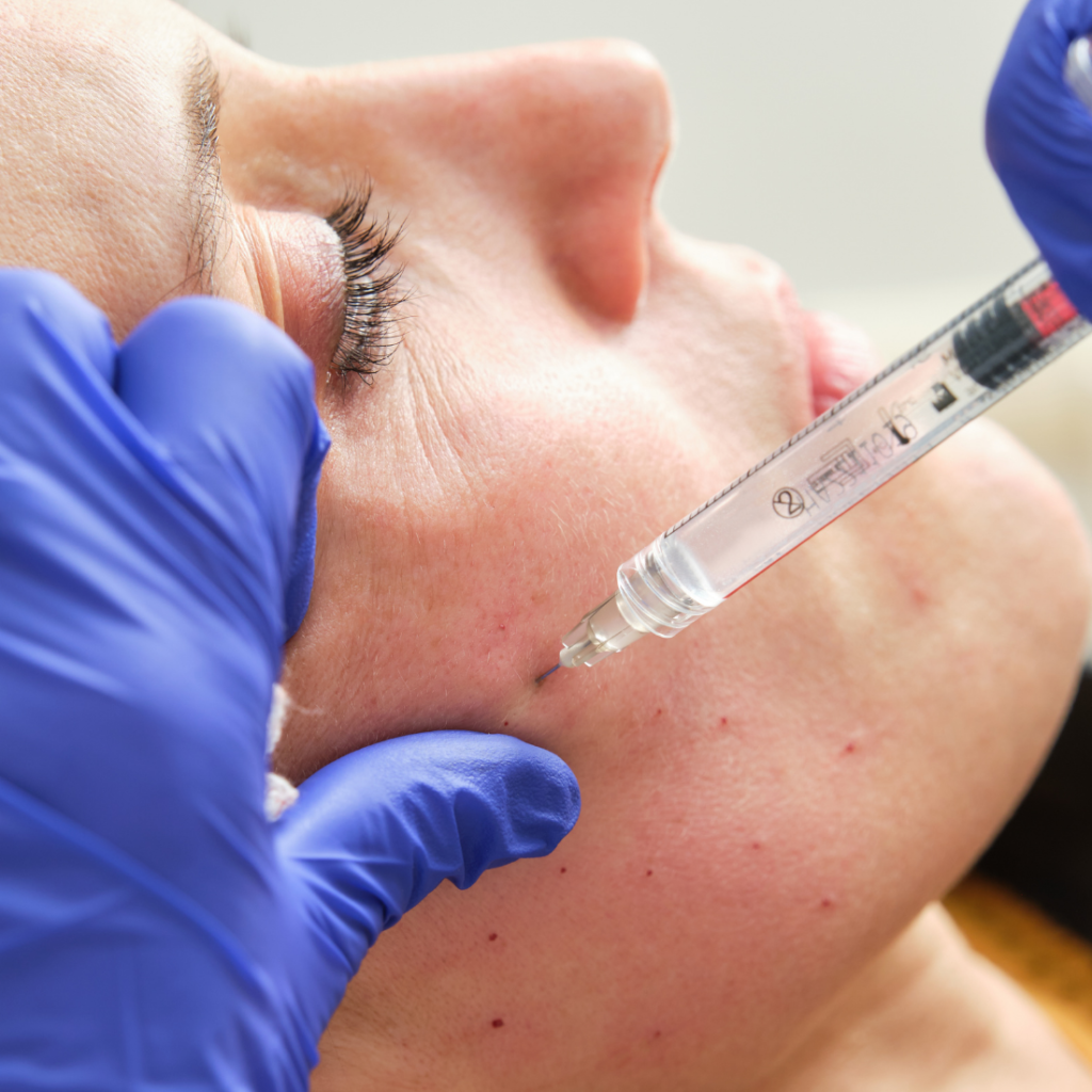 Jak działa mezoterapia? Co dzieje się w skórze | Ilustre Wrocław