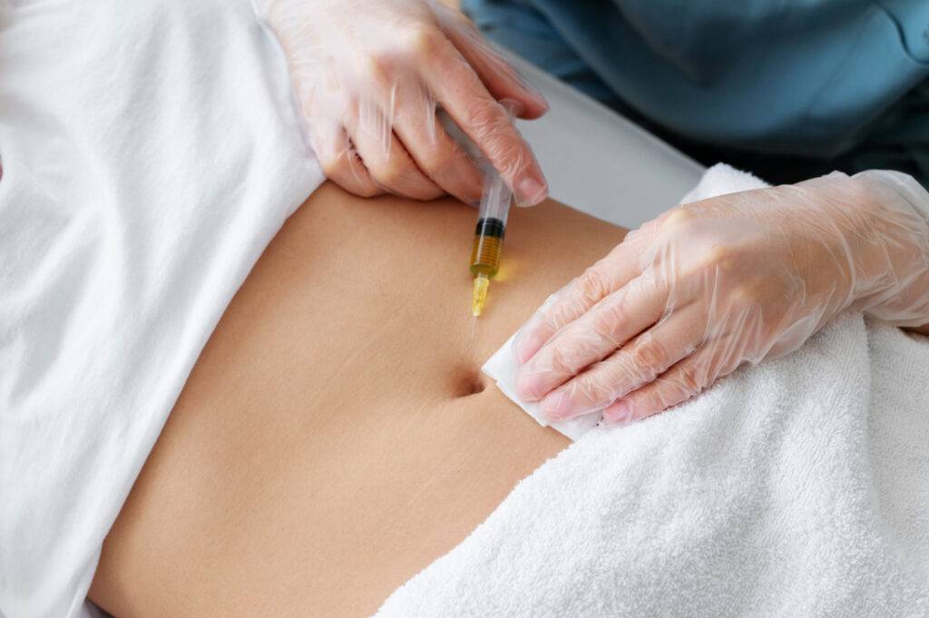 A person wearing gloves injects a syringe with yellow liquid into the abdomen of another person, who is lying down with a towel covering their lower body in a klinika medycyny estetycznej.