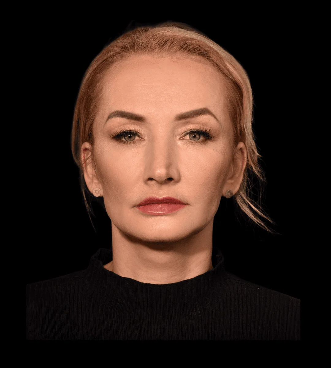 zdjęcie pacjentki po metamorfozie w Illustre