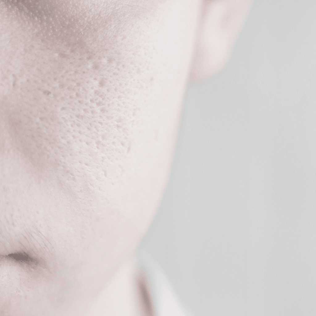 Close-up of the left side of a person’s face with visible pores and textured skin, softly lit against a neutral background—capturing natural beauty often highlighted in klinika medycyny estetycznej and medycyna estetyczna Wrocław treatments.