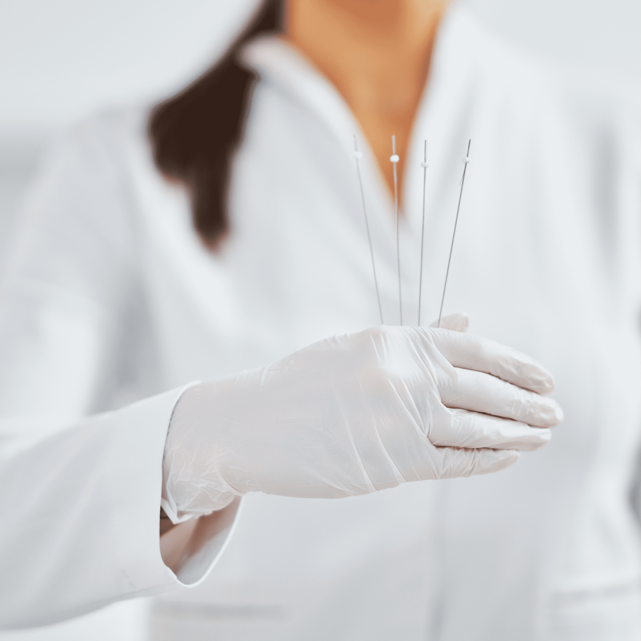 Nici liftingujące haczykowe w Illustre – naturalne uniesienie tkanek twarzy wykonane z precyzją i bez efektu przerysowania.