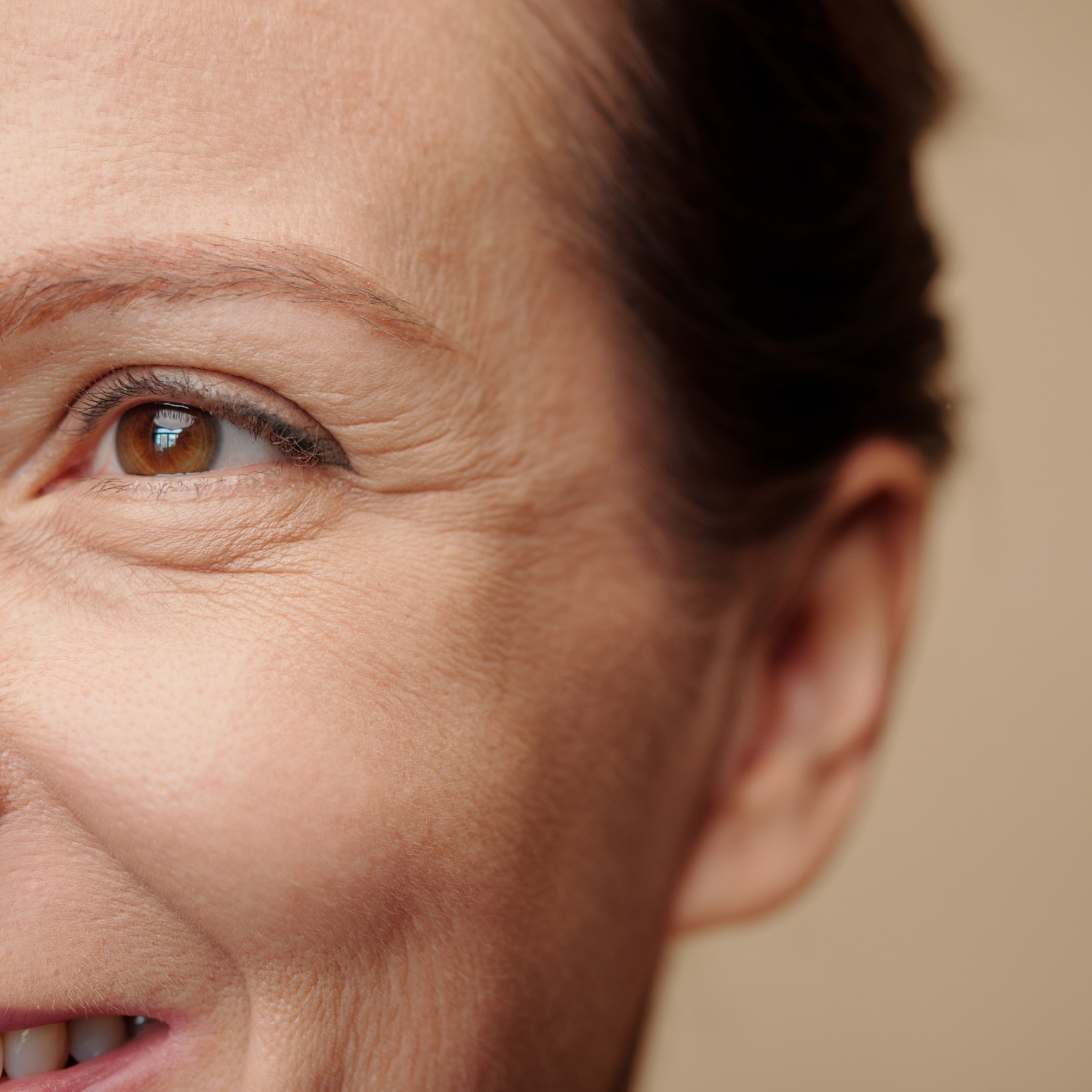 Czy botoks bez mezoterapii ma sens? | Illustre Wrocław